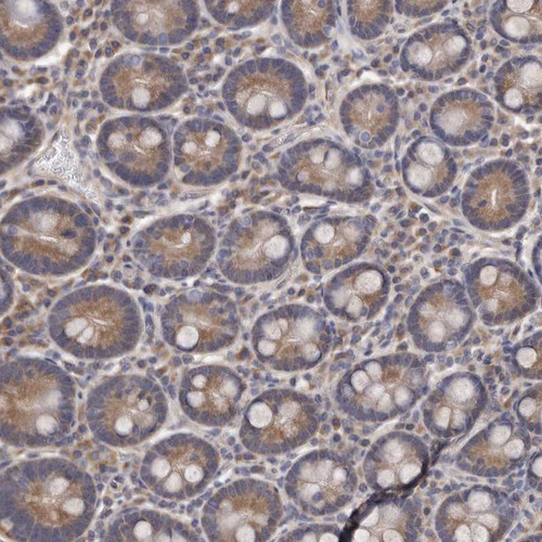 Immunohistochemical staining of human duodenum shows moderate cytoplasmic positivity in glandular cells.