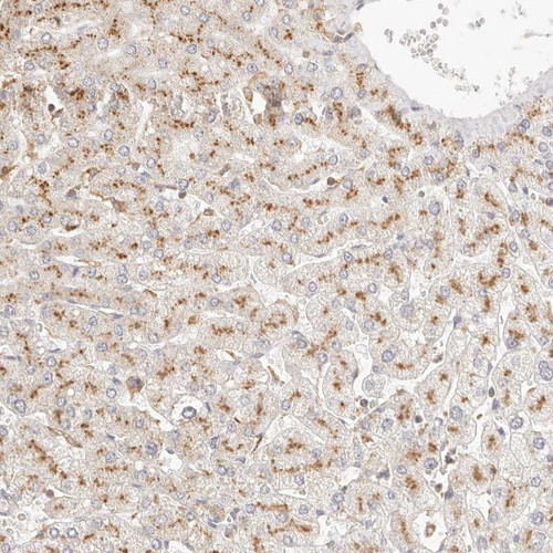 Immunohistochemical staining of human liver shows moderate granular cytoplasmic positivity in hepatocytes.