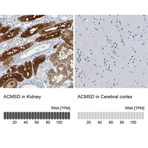 Immunohistochemistry analysis in human kidney and cerebral cortex tissues using HPA010533 antibody. Corresponding ACMSD RNA-seq data are presented for the same tissues.