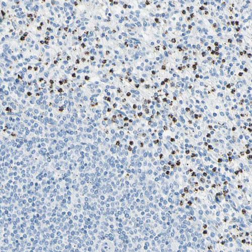 Immunohistochemical staining of human spleen shows strong cytoplasmic/membranous positivity in cells in red pulp.
