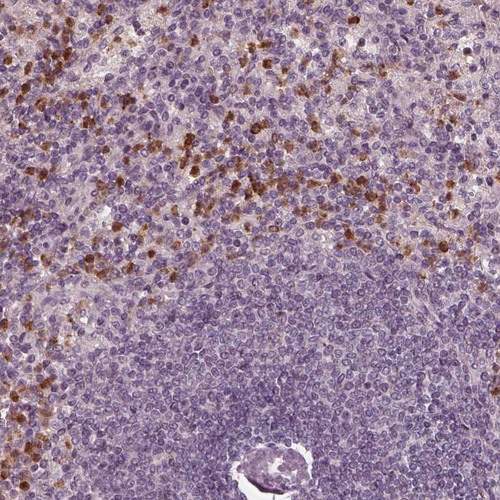 Immunohistochemical staining of human spleen shows moderate to strong cytoplasmic positivity in cells in red pulp.