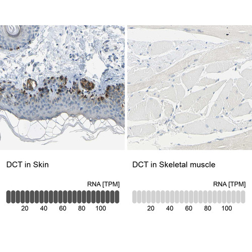 Immunohistochemistry analysis in human skin and skeletal muscle tissues using Anti-DCT antibody. Corresponding DCT RNA-seq data are presented for the same tissues.