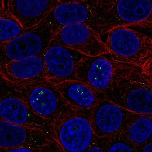 Immunofluorescent staining of human cell line MCF7 shows localization to nucleoli fibrillar center & vesicles.
