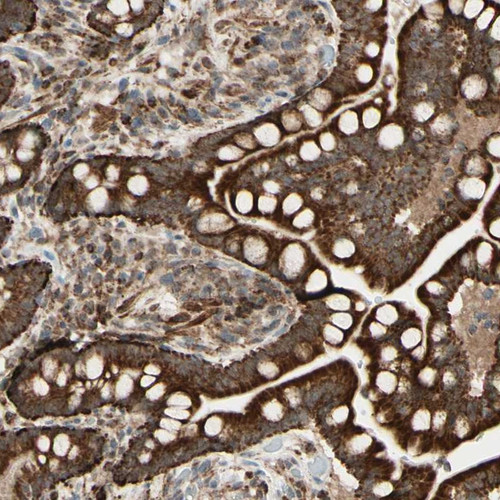 Immunohistochemical staining of human colon shows strong cytoplasmic positivity in glandular cells.