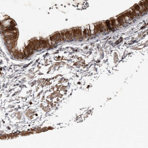 Immunohistochemical staining of human bronchus shows strong positivity in respiratory epithelial cells.