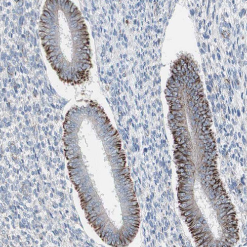 Immunohistochemical staining of human corpus, uterine shows strong cytoplasmic positivity in glandular cells.
