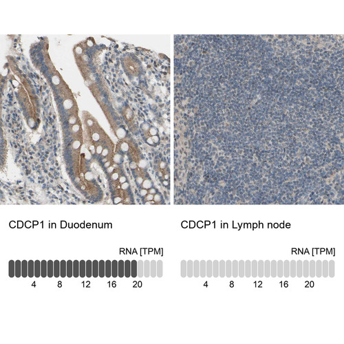 Immunohistochemistry analysis in human duodenum and lymph node tissues using HPA010978 antibody. Corresponding CDCP1 RNA-seq data are presented for the same tissues.