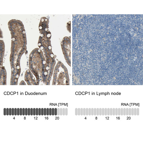 Immunohistochemistry analysis in human duodenum and lymph node tissues using HPA010979 antibody. Corresponding CDCP1 RNA-seq data are presented for the same tissues.