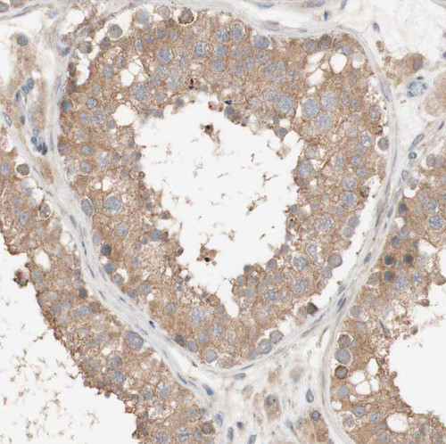 Immunohistochemical staining of human testis shows moderate cytoplasmic positivity in cells in seminiferous ducts.