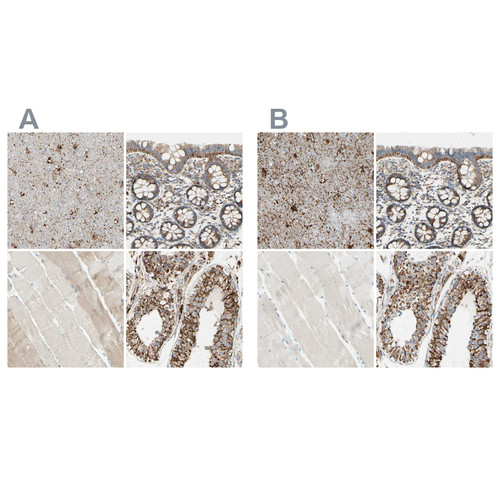 Immunohistochemical staining of human cerebral cortex, colon, skeletal muscle and testis using Anti-ARMC10 antibody HPA011036 (A) shows similar protein distribution across tissues to independent antibody HPA011057 (B).
