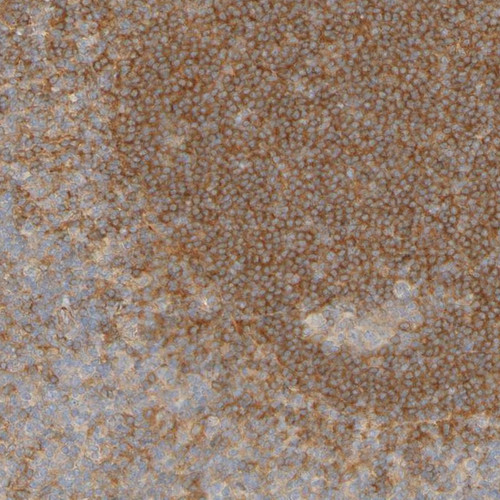 Immunohistochemical staining of human tonsil shows strong cytoplasmic positivity in reaction center cells.