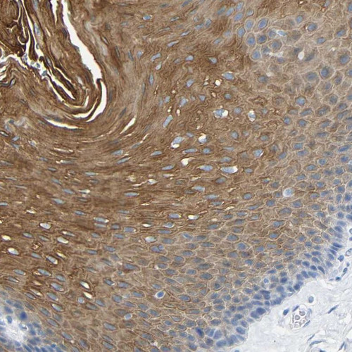 Immunohistochemical staining of human esophagus shows strong cytoplasmic positivity in squamous epithelial cells.