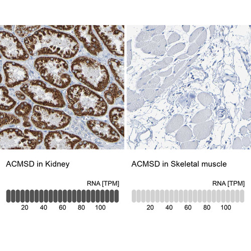 Immunohistochemistry analysis in human kidney and skeletal muscle tissues using HPA011179 antibody. Corresponding ACMSD RNA-seq data are presented for the same tissues.
