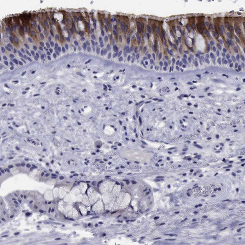 Immunohistochemical staining of human bronchus shows moderate cytoplasmic positivity in respiratory epithelial cells.