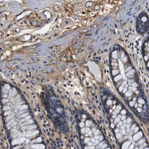 Immunohistochemical staining of human colon shows moderate positivity in extracellular matrix.