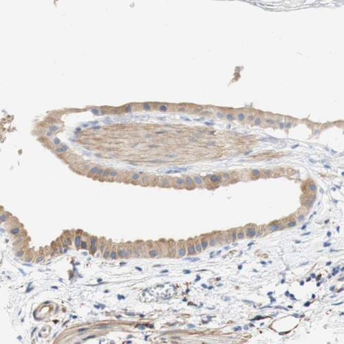 Immunohistochemical staining of human gallbladder shows weak cytoplasmic positivity in glandular cells.