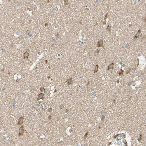 Immunohistochemical staining of human cerebral cortex shows moderate to strong cytoplasmic positivity in neurons.