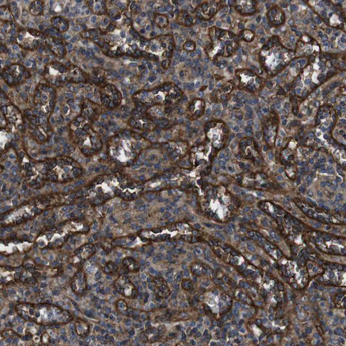 Immunohistochemical staining of human spleen shows strong membranous positivity in cells in red pulp.
