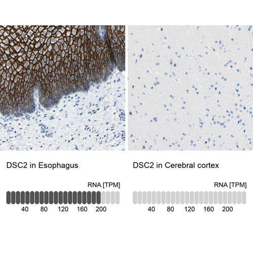 Immunohistochemistry analysis in human esophagus and cerebral cortex tissues using HPA011911 antibody. Corresponding DSC2 RNA-seq data are presented for the same tissues.