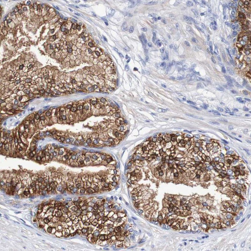 Immunohistochemical staining of human prostate shows strong cytoplasmic and membranous positivity in glandular cells.