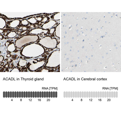 Immunohistochemistry analysis in human thyroid gland and cerebral cortex tissues using HPA011990 antibody. Corresponding ACADL RNA-seq data are presented for the same tissues.