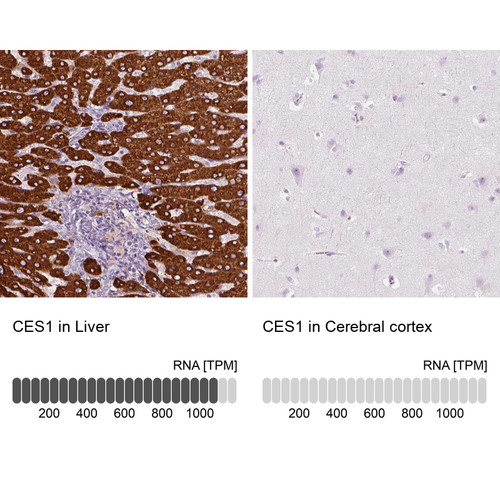 Immunohistochemistry analysis in human liver and cerebral cortex tissues using HPA012023 antibody. Corresponding CES1 RNA-seq data are presented for the same tissues.