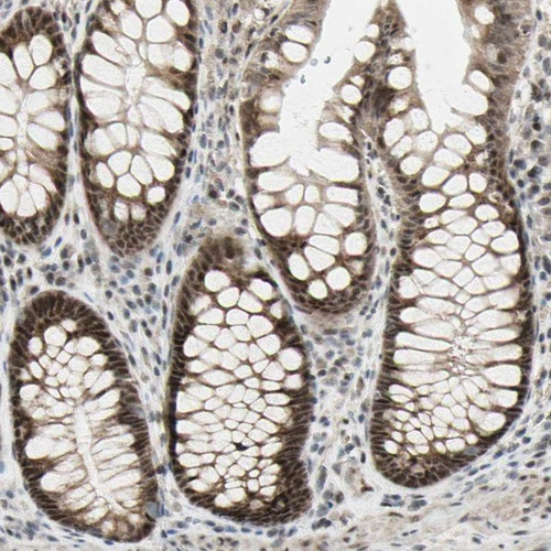Immunohistochemical staining of human colon shows strong nuclear and cytoplasmic positivity in glandular cells.