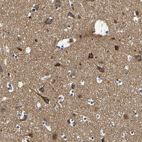 Immunohistochemical staining of human cerebral cortex shows strong cytoplasmic positivity in neuronal cells.