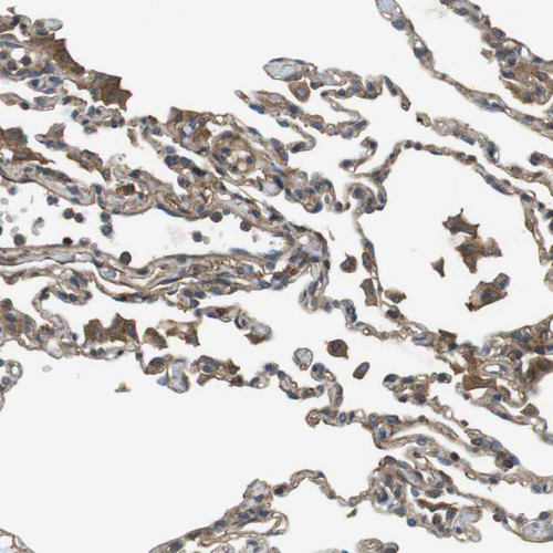 Immunohistochemical staining of human lung shows moderate cytoplasmic positivity in macrophages.