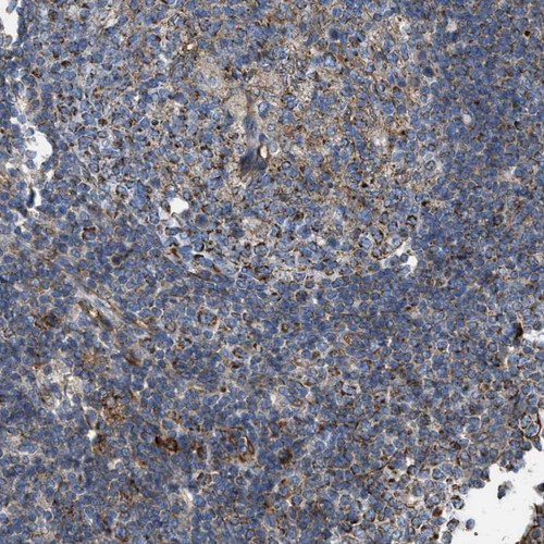 Immunohistochemical staining of human lymph node shows strong membranous positivity in non-germinal center and germinal center cells.