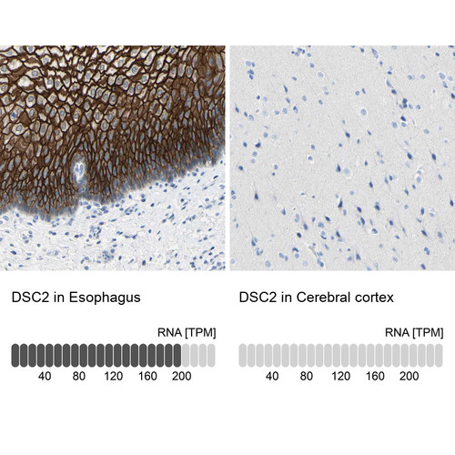 Immunohistochemistry analysis in human esophagus and cerebral cortex tissues using HPA012615 antibody. Corresponding DSC2 RNA-seq data are presented for the same tissues.