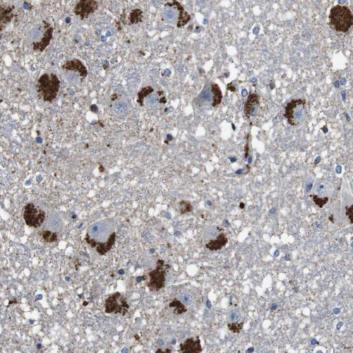 Immunohistochemical staining of human hippocampus shows strong cytoplasmic positivity, with a granular pattern, in neuronal and glial cells.