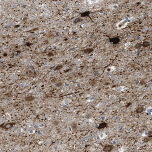 Immunohistochemical staining of human cerebral cortex shows moderate to strong cytoplasmic positivity in neurons.