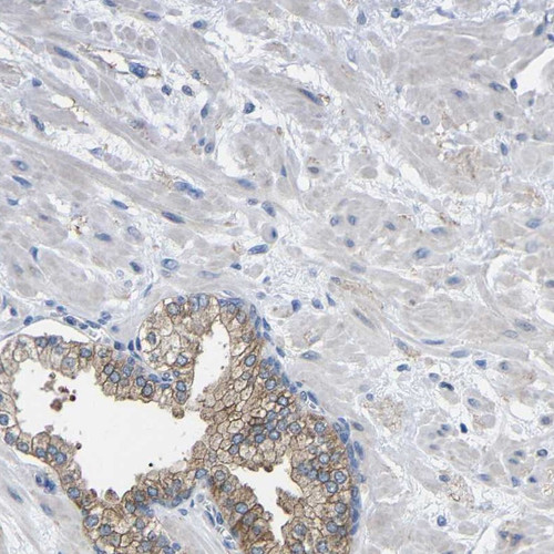 Immunohistochemical staining of human prostate shows moderate membranous positivity in glandular cells.