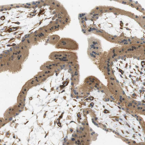 Immunohistochemical staining of human placenta shows strong cytoplasmic positivity in trophoblastic cells.