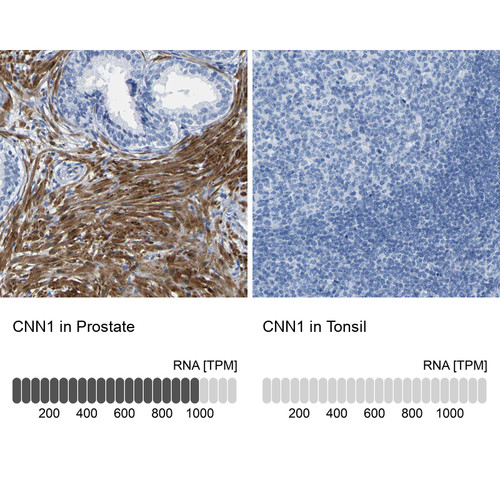 Immunohistochemistry analysis in human prostate and tonsil tissues using HPA014263 antibody. Corresponding CNN1 RNA-seq data are presented for the same tissues.
