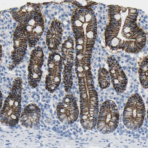 Immunohistochemical staining of human duodenum shows strong membranous positivity in glandular cells.