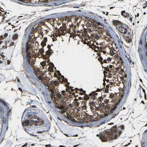 Immunohistochemical staining of human testis shows moderate to strong cytoplasmic positivity in cells in seminiferous ducts.