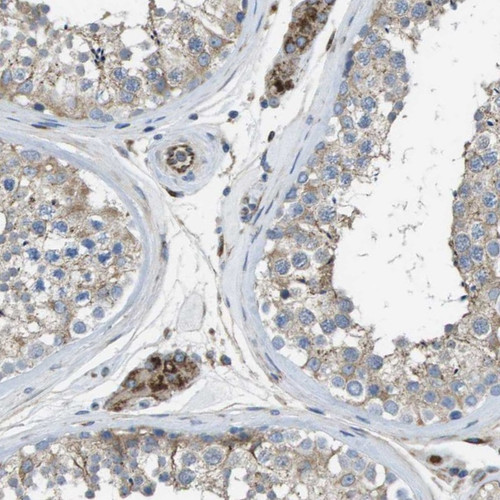 Immunohistochemical staining of human testis shows strong cytoplasmic positivity in Leydig cells.