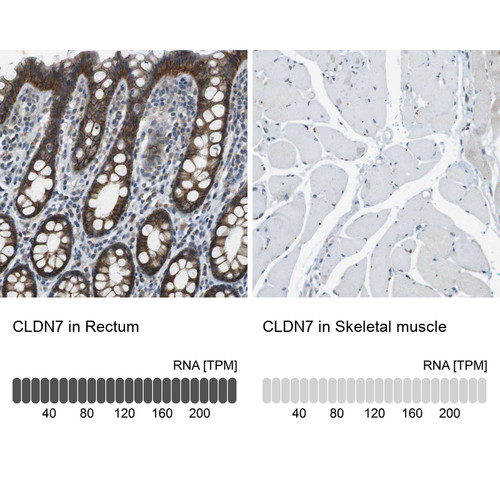 Immunohistochemistry analysis in human rectum and skeletal muscle tissues using Anti-CLDN7 antibody. Corresponding CLDN7 RNA-seq data are presented for the same tissues.