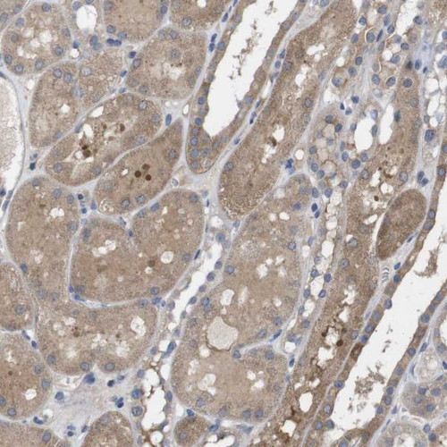 Immunohistochemical staining of human kidney shows moderate cytoplasmic positivity in tubular cells.