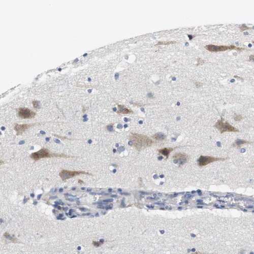 Immunohistochemical staining of human cerebral cortex shows moderate cytoplasmic positivity in neuronal cells.