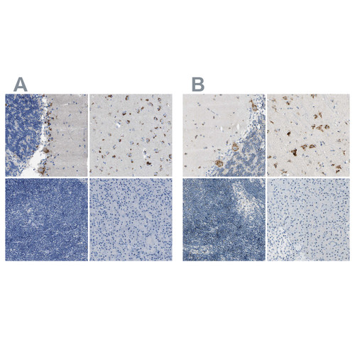 Immunohistochemical staining of human cerebellum, cerebral cortex, lymph node and pancreas using Anti-B4GALNT1 antibody HPA015128 (A) shows similar protein distribution across tissues to independent antibody HPA008968 (B).