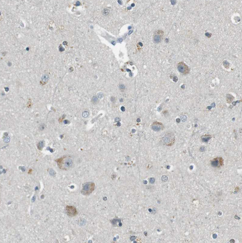 Immunohistochemical staining of human Cerebral cortex shows moderate cytoplasmic positivity in neuronal cells.