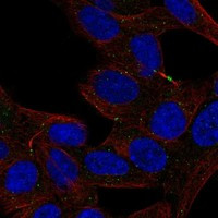Immunofluorescent staining of human cell line SH-SY5Y shows localization to midbody & vesicles.