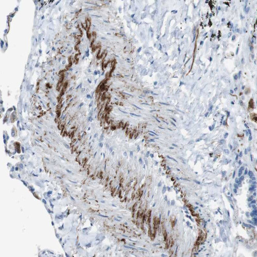 Immunohistochemical staining of human blood vessel shows distinct positivity in internal elastic lamina.