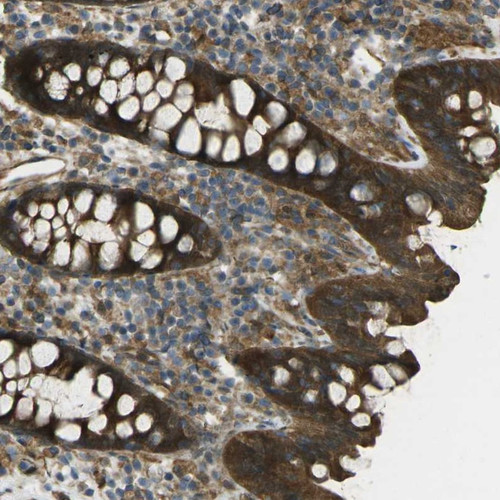 Immunohistochemical staining of human colon shows strong cytoplasmic positivity in glandular cells.