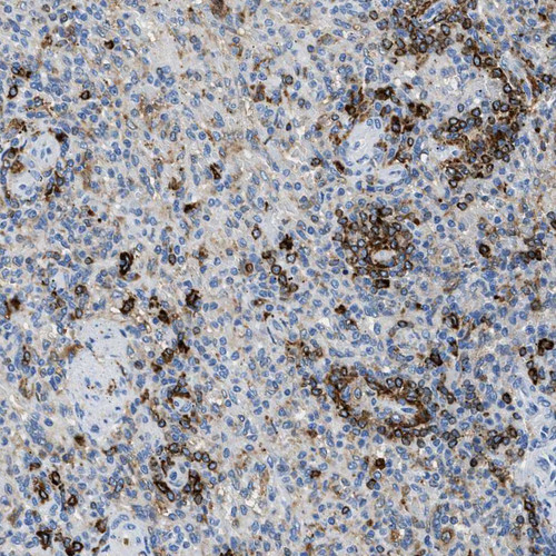 Immunohistochemical staining of human spleen shows moderate positivity in lymphoid cells.