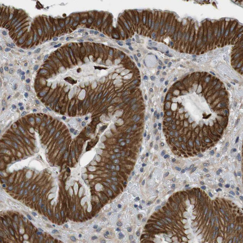 Immunohistochemical staining of human stomach shows strong membranous and cytoplasmic positivity in glandular cells.
