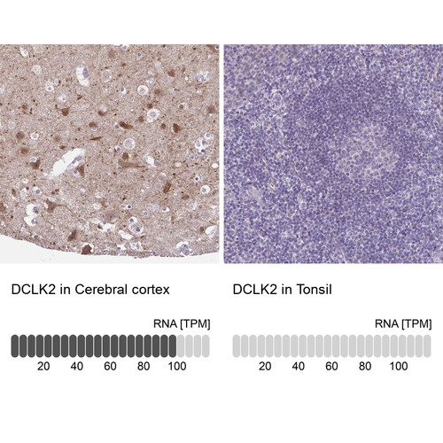 Immunohistochemistry analysis in human cerebral cortex and tonsil tissues using Anti-DCLK2 antibody. Corresponding DCLK2 RNA-seq data are presented for the same tissues.